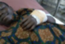 JHS student slashed with cutlass